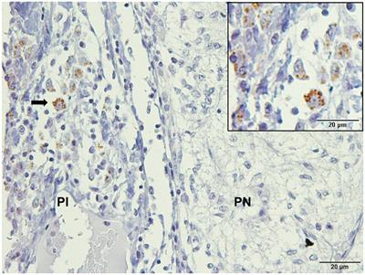 Lymphocytic hypophysitis in dogs infected with Leishmania spp.